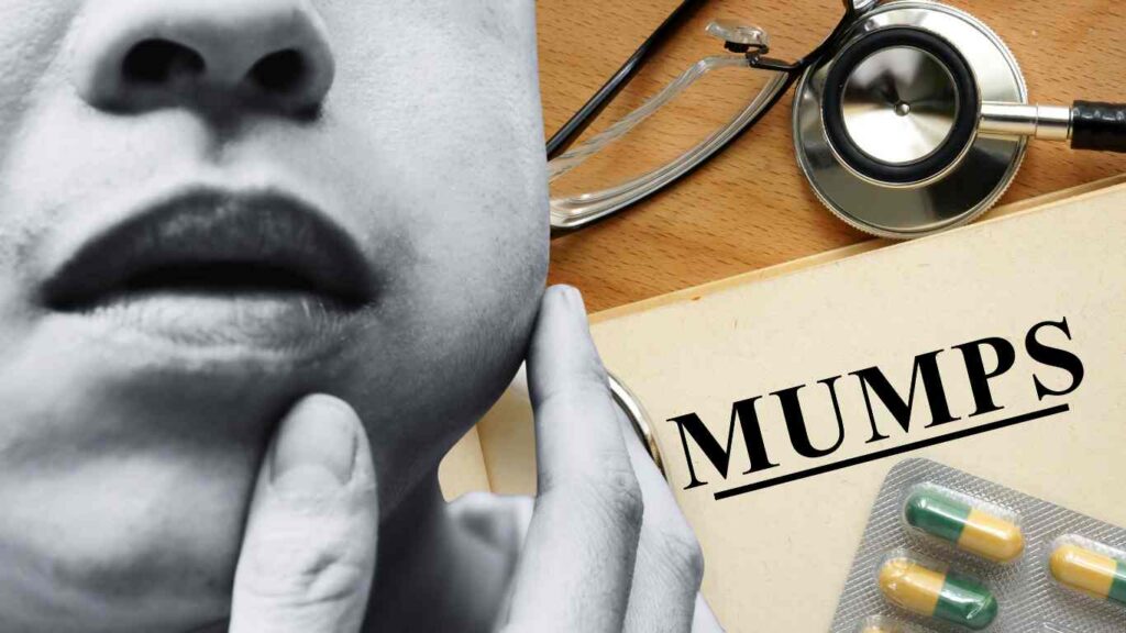 Fear Grips Nairobi Schools Following Suspected Mumps Infections